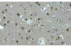 Immunohistochemistry of paraffin-embedded Human brain tissue using MAP2 Monoclonal Antibody at dilution of 1:200. (MAP2 Antikörper)