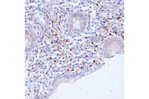 Immunohistochemistry of paraffin-embedded human appendix using WIPF1 antibody (ABIN7271348) at dilution of 1:100 (40x lens).