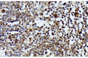 Immunohistochemistry of paraffin-embedded Human appendix using MAP3K3 Polyclonal Antibody at dilution of 1:100 (40x lens). (MAP3K3 Antikörper)