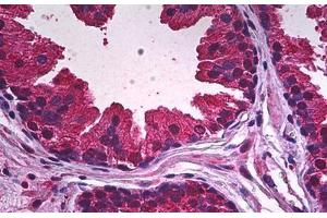 Human Prostate, Epithelium: Formalin-Fixed, Paraffin-Embedded (FFPE) (PDE9A Antikörper)