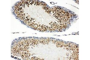 IHC-P: TIM-1 antibody testing of rat testis tissue (HAVCR1 Antikörper  (AA 289-307))