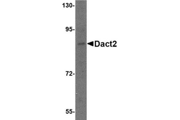DACT2 antibody  (N-Term)