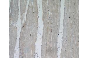 Immunohistochemistry (IHC) image for anti-Xin Actin-Binding Repeat Containing 2 (XIRP2) antibody (ABIN2906145) (XIRP2 Antikörper)