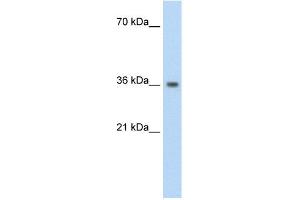 WB Suggested Anti-PHYHIP Antibody Titration:  1. (PHYHIP Antikörper  (N-Term))