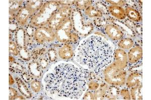 AP31060PU-N WRNIP1 antibody staining of paraffin embedded Human Kidney. (WRNIP1 Antikörper  (C-Term))
