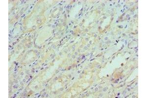 Immunohistochemistry (IHC) image for anti-serpin Peptidase Inhibitor, Clade A (Alpha-1 Antiproteinase, Antitrypsin), Member 6 (SERPINA6) (AA 136-405) antibody (ABIN7148620)