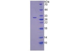 SDS-PAGE analysis of Human TNKS2 Protein. (TNKS2 Protein)
