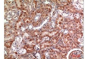 Immunohistochemistry (IHC) analysis of paraffin-embedded Human Kidney, antibody was diluted at 1:100. (M-CSF/CSF1 Antikörper  (Internal Region))