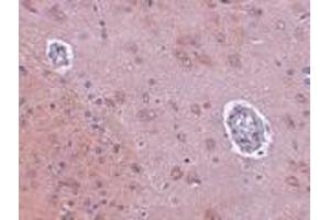 Immunohistochemistry of FAM120A in rat brain tissue with FAM120A antibody at 2. (FAM120A Antikörper  (Center))