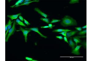Immunofluorescence (IF) image for anti-RELT Tumor Necrosis Factor Receptor (RELT) (AA 1-430) antibody (ABIN529851)