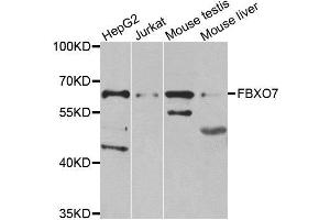 Western blot analysis of extracts of various cell lines, using FBXO7 antibody.