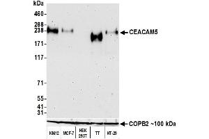 Western Blotting (WB) image for anti-Carcinoembryonic Antigen-Related Cell Adhesion Molecule 5 (CEACAM5) (AA 35-685) antibody (ABIN7453964) (Rekombinanter CEACAM5 Antikörper  (AA 35-685))