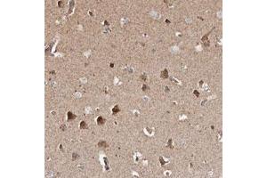 Immunohistochemical staining (Formalin-fixed paraffin-embedded sections) of human cerebral cortex with PRKACB polyclonal antibody  shows strong cytoplasmic positivity in neuronal cells. (PRKACB Antikörper)