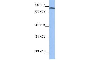 WB Suggested Anti-ADAM7 Antibody Titration: 0. (ADAM7 Antikörper  (C-Term))