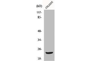 Western Blot analysis of COLO205 cells using Mob3B Polyclonal Antibody (MOBKL2B Antikörper  (Internal Region))