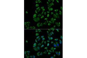 Immunofluorescence analysis of HeLa cells using PEX5 antibody (ABIN5973402). (PEX5 Antikörper)