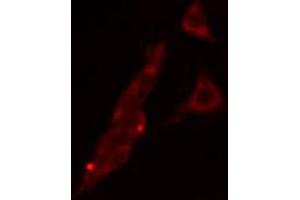 ABIN6268691 staining HeLa cells by IF/ICC. (TJP1 Antikörper)