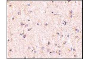 Immunohistochemistry of IRGM in human brain with this product at 5 μg/ml. (IRGM Antikörper  (Center))