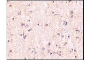 Immunohistochemistry of IRGM in human brain with this product at 5 μg/ml.