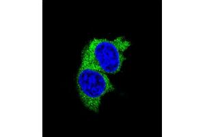 Confocal iunofluorescent analysis of P1 Antibody (Center) (ABIN655817 and ABIN2845241) with MDA-M cell followed by Alexa Fluor 488-conjugated goat anti-rabbit lgG (green). (MMP1 Antikörper  (AA 317-347))