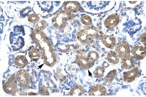 Rabbit Anti-CBX 4 Antibody Catalog Number: ARP30002 Paraffin Embedded Tissue: Human Kidney Cellular Data: Epithelial cells of renal tubule Antibody Concentration: 4. (CBX4 Antikörper  (N-Term))