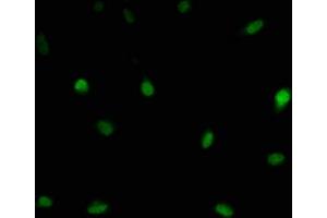 Immunofluorescence staining of U251 cells with ABIN7174212 at 1:166, counter-stained with DAPI. (LSM11 Antikörper  (AA 1-141))