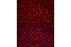 Immunofluorescence analysis of rat brain using Calretinin Rabbit pAb (ABIN6129247, ABIN6137849, ABIN6137850 and ABIN6225108) at dilution of 1:250 (40x lens).