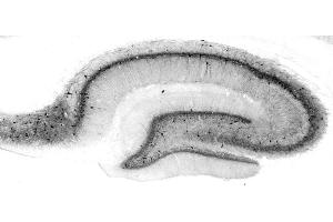 Adult rat hippocampus immunohistochemistry.