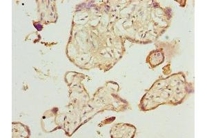 Immunohistochemistry of paraffin-embedded human placenta tissue using ABIN7173063 at dilution of 1:100 (TMEM143 Antikörper  (AA 8-278))