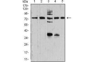 Western blot analysis using SYN1 mouse mAb against NIH/3T3 (1), U251 (2), C6 (3), A549 (4), and MCF-7 (5) cell lysate. (SYN1 Antikörper  (AA 362-511))