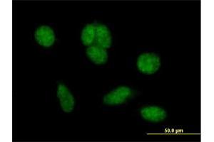 Immunofluorescence of purified MaxPab antibody to C1orf181 on HeLa cell. (ZNHIT6 Antikörper  (AA 1-470))