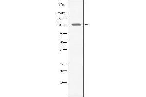 Western blot analysis of extracts from HeLa cells using AMPD2 antibody. (AMPD2 Antikörper  (N-Term))