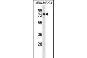 SLFN12 Antibody (Center) (ABIN1538019 and ABIN2849329) western blot analysis in MDA-M cell line lysates (35 μg/lane). (SLFN12 Antikörper  (AA 192-220))