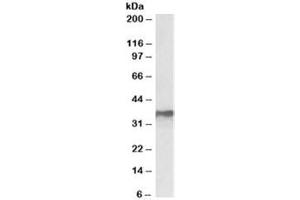 Western blot testing of MCF7 lysate with HNRNPA2B1 antibody at 0. (HNRNPA2B1 Antikörper)