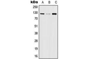 Western blot analysis of JAK2 (pY570) expression in HeLa (A), TF1 (B), NIH3T3 (C), rat kidney (D) whole cell lysates. (JAK2 Antikörper  (pTyr570))