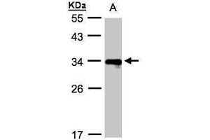 WB Image Sample(30 ug whole cell lysate) A:Raji , 12% SDS PAGE antibody diluted at 1:1000 (HLA-DRB4 Antikörper  (Center))