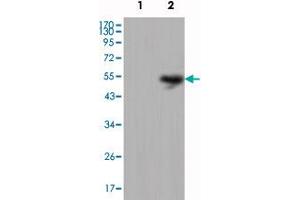 Western blot analysis using LCN1 monoclonal antibody, clone 10B10  against HEK293 (1) and LCN1-hIgGFc transfected HEK293 cell lysate (2). (Lipocalin 1 Antikörper)