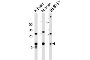 STMN2 antibody  (AA 82-116)