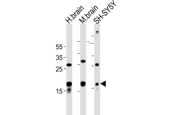 STMN2 anticorps  (AA 82-116)