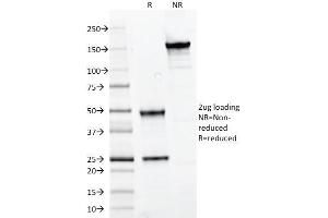 SDS-PAGE Analysis Purified PAX7 Mouse Monoclonal Antibody (PAX7/497). (PAX7 Antikörper  (AA 301-505))