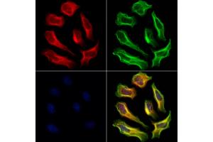 ABIN6264995 and ABIN6273073 staining Hela cells by IF/ICC. (Septin 9 Antikörper  (C-Term))