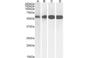 Western Blot using anti-Beta-Tubulin antibody S11B. (Rekombinanter TUBB Antikörper)