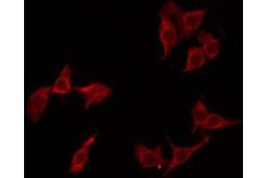 ABIN6275259 staining LOVO by IF/ICC. (MNDA Antikörper  (Internal Region))