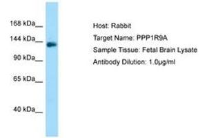 Image no. 1 for anti-Protein Phosphatase 1, Regulatory (Inhibitor) Subunit 9A (PPP1R9A) (C-Term) antibody (ABIN6750130)