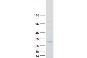 Western Blotting (WB) image for Complement Component 1, Q Subcomponent, C Chain (C1QC) (Transcript Variant 2) protein (Myc-DYKDDDDK Tag) (ABIN2715459)