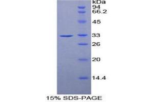 SDS-PAGE (SDS) image for Ribonuclease/angiogenin Inhibitor 1 (RNH1) (AA 76-333) protein (His tag) (ABIN1879333) (RNH1 Protein (AA 76-333) (His tag))