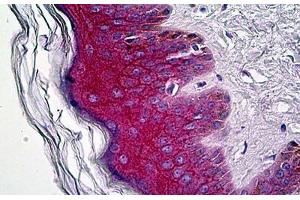 Anti-Gamma Catenin antibody IHC staining of human skin. (JUP Antikörper  (C-Term))