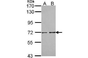Western Blotting (WB) image for anti-Protein Phosphatase 2, Regulatory Subunit B', delta (PPP2R5D) (C-Term) antibody (ABIN2856363)