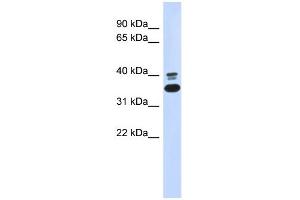WB Suggested Anti-ABHD7 Antibody Titration: 0. (EPHX4 Antikörper  (N-Term))