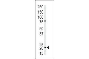 The anti-CDKN1A Pab (ABIN391763 and ABIN2841628) is used in Western blot to detect CDKN1A in T-47D cell lysate. (p21 Antikörper  (C-Term))